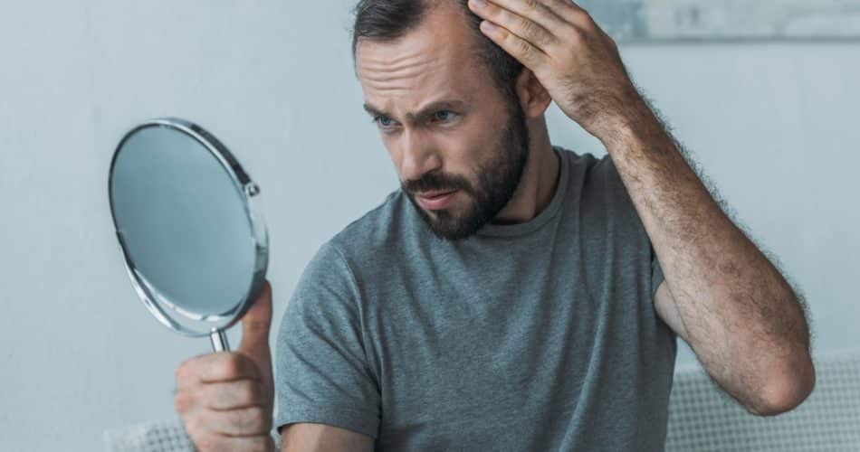 bearded middle aged man with alopecia looking at mirror, hair loss concept