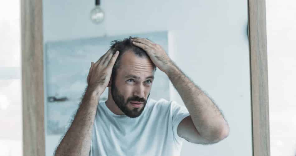 middle aged man with alopecia looking at mirror, hair loss concept